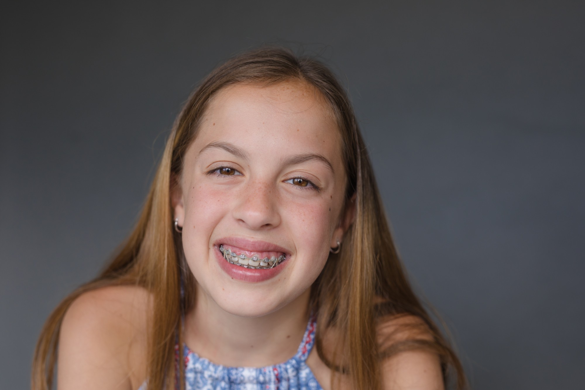 Traditional Braces in New Jersey