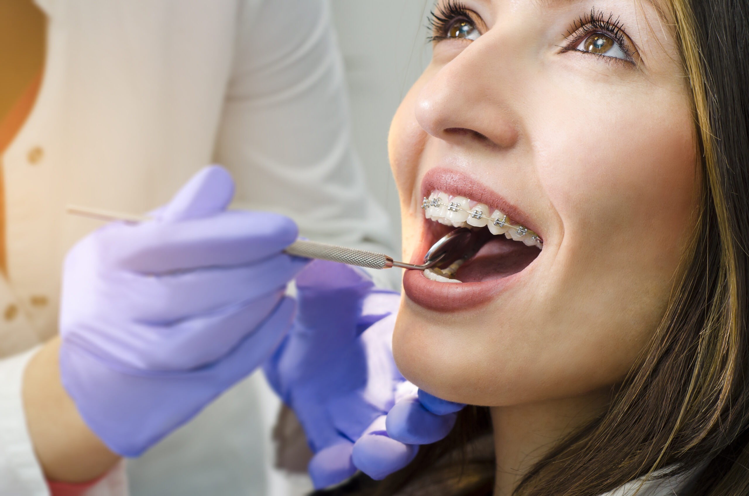 How Do Braces Work?