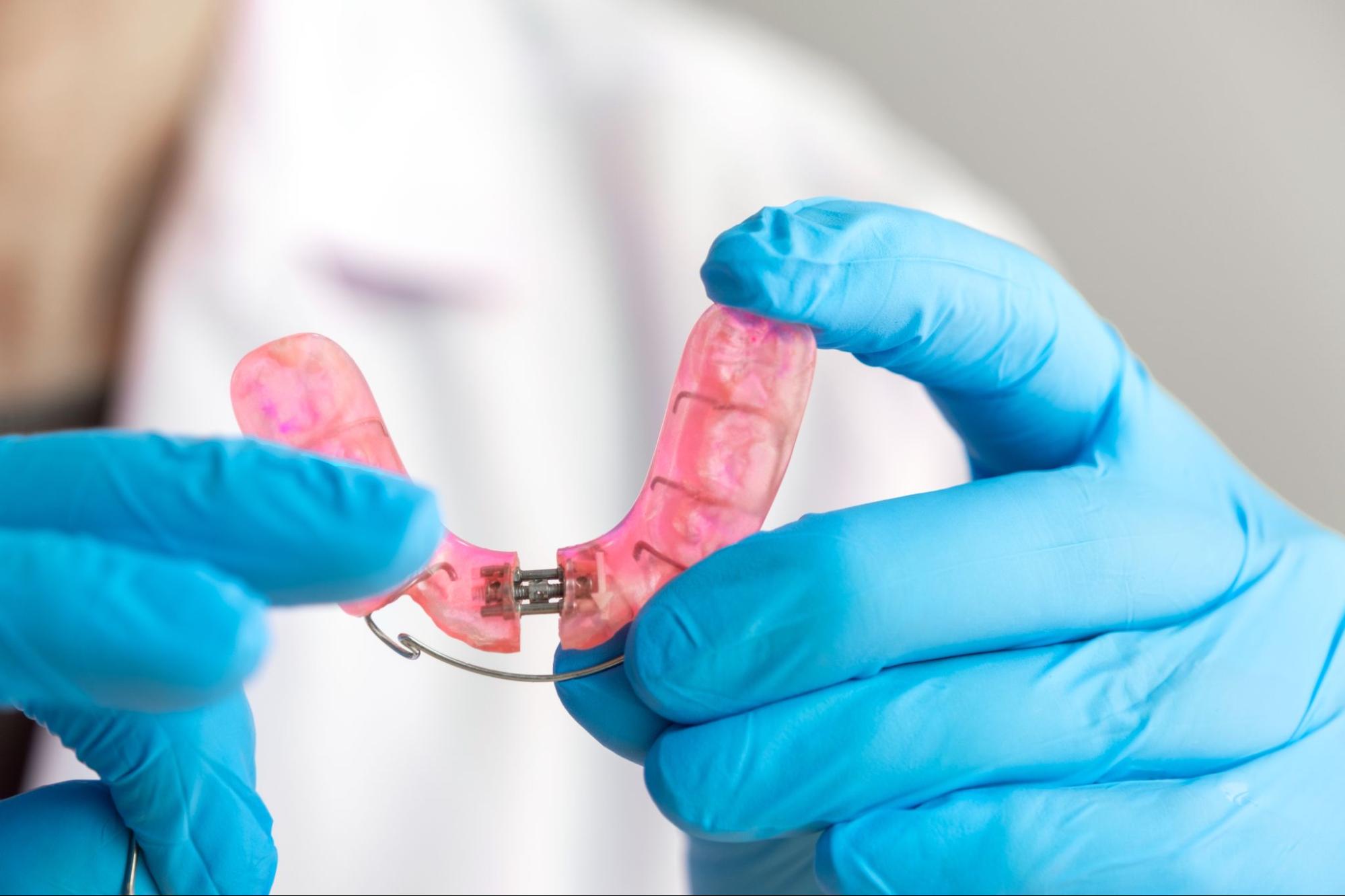 Why Choose Fixed Retainers | Ollins Orthodontics