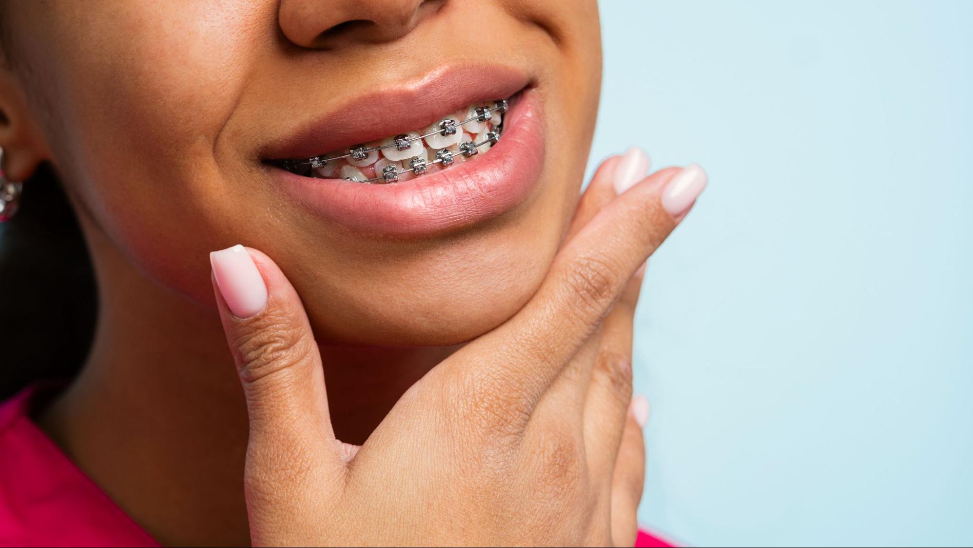 Clifton Braces