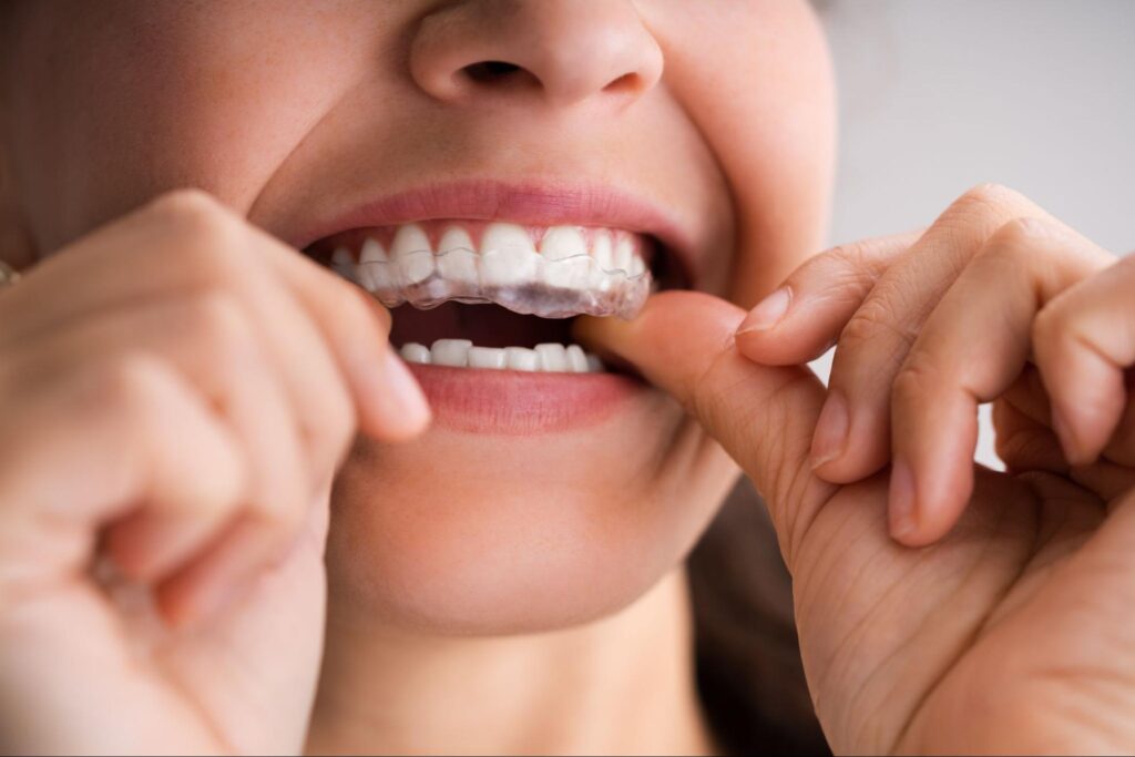 Clifton Invisalign